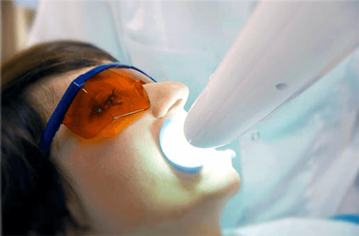 Understanding the Causes of Teeth Sensitivity Tamworth