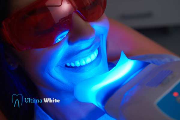 Professional Teeth Whitening Options Tamworth