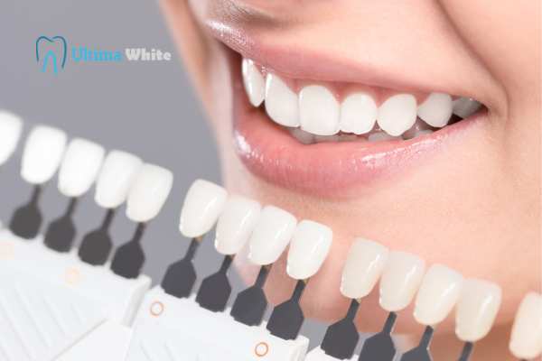 How to Maximise the Results of Your Laser Teeth Whitening Treatment Tamworth