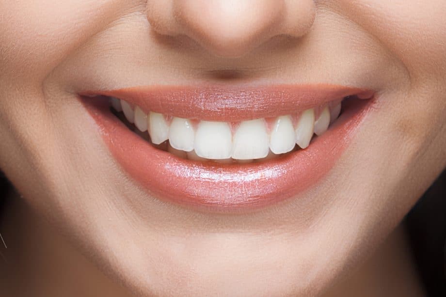 The Impact of White Spots on Oral Health Tamworth