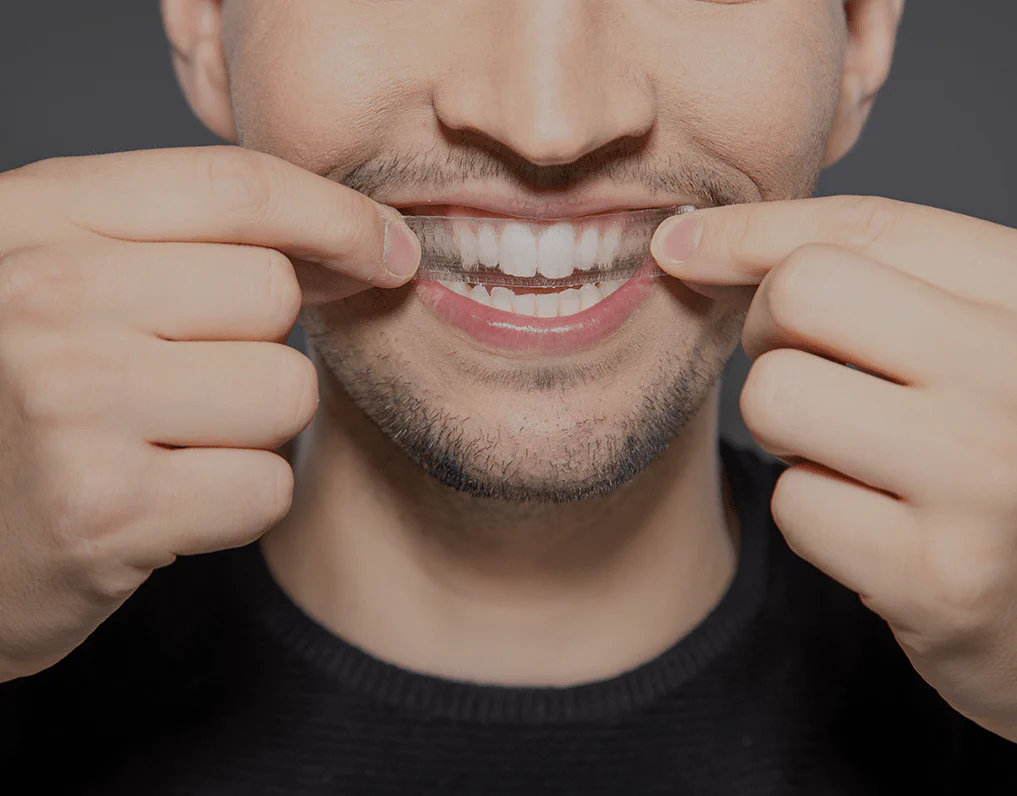 How Are Invisible Aligners Changing Orthodontic Treatments Tamworth?