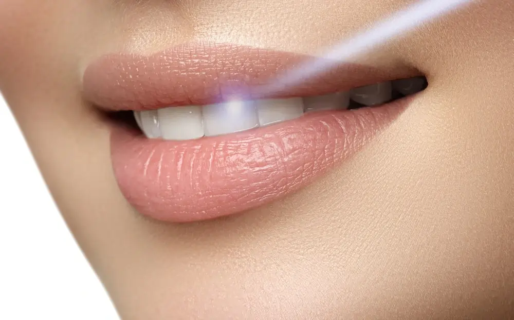 Understanding Teeth Whitening Risks and Results Tamworth
