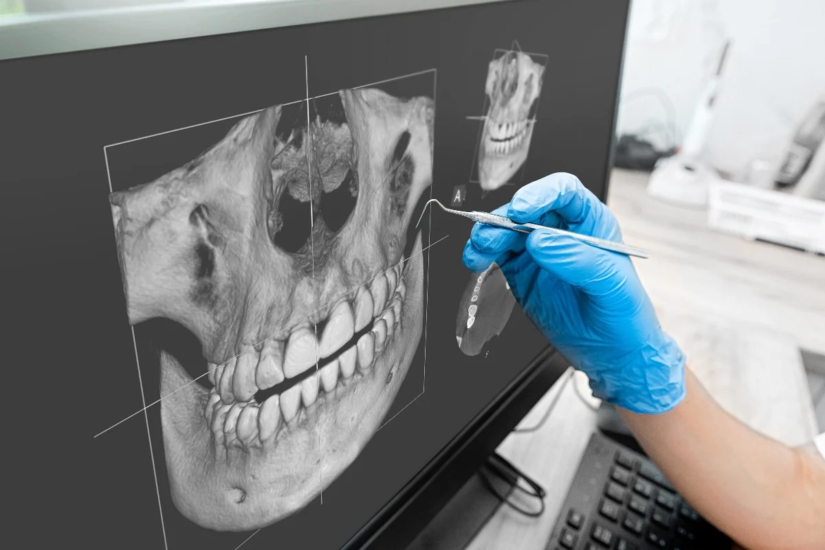 How Is AI Transforming Dental Treatment Planning Tamworth?