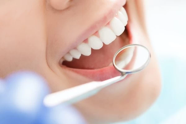 Preventing White Spots on Teeth Tamworth