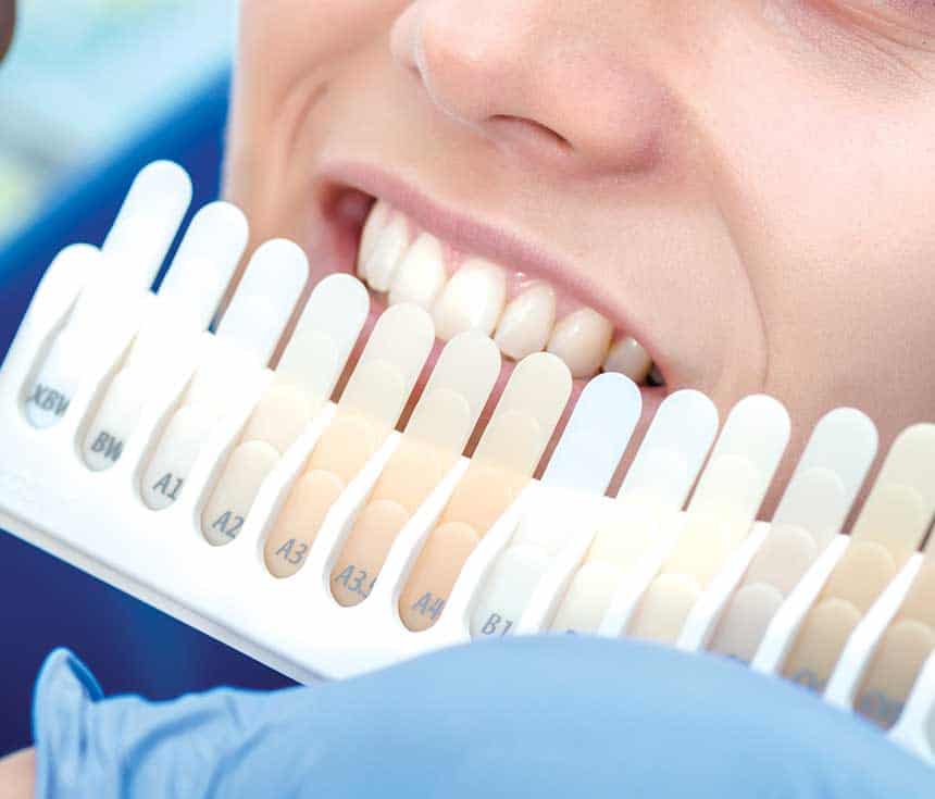 Is Laser Teeth Whitening Worth It for a Brighter, Confident Smile Tamworth?