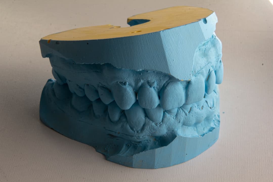 How Do Dental Implants Improve Jawbone Health and Oral Function Tamworth?