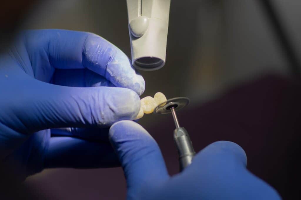 Customised Dental Solutions: Crowns, Aligners, and Implants Tamworth
