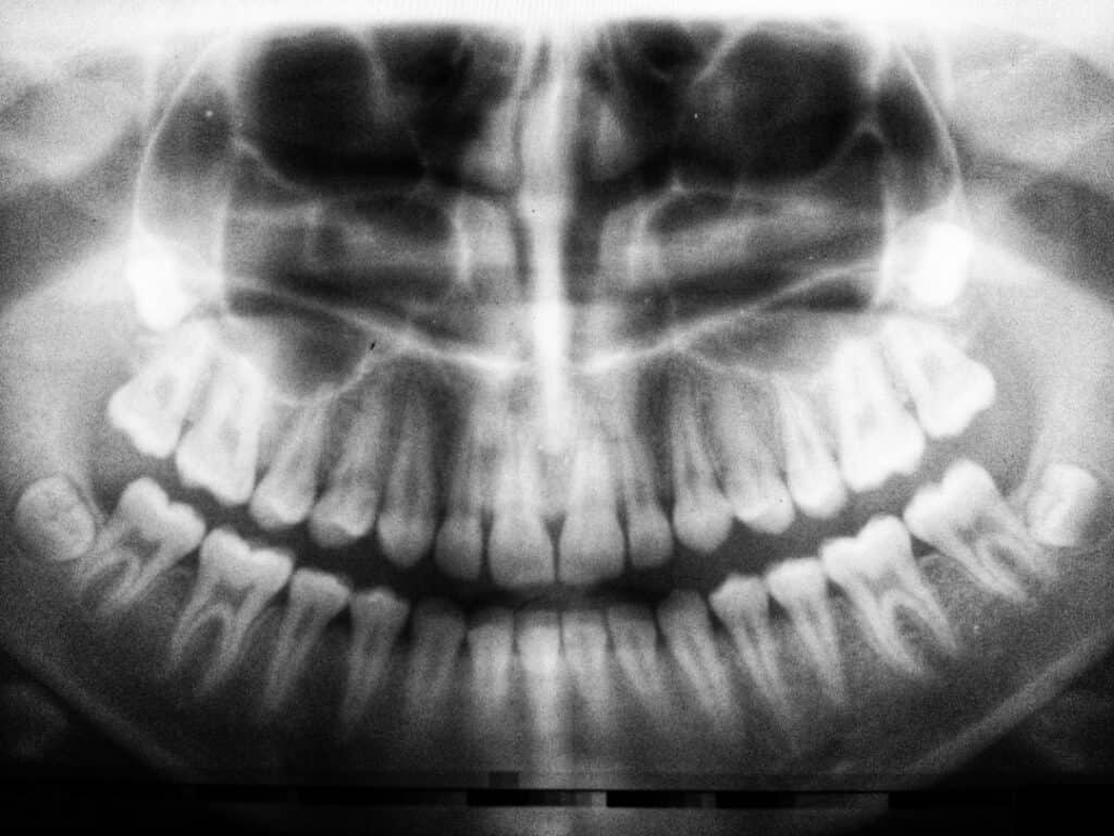 The Future of 3D Printing in Oral Healthcare Tamworth